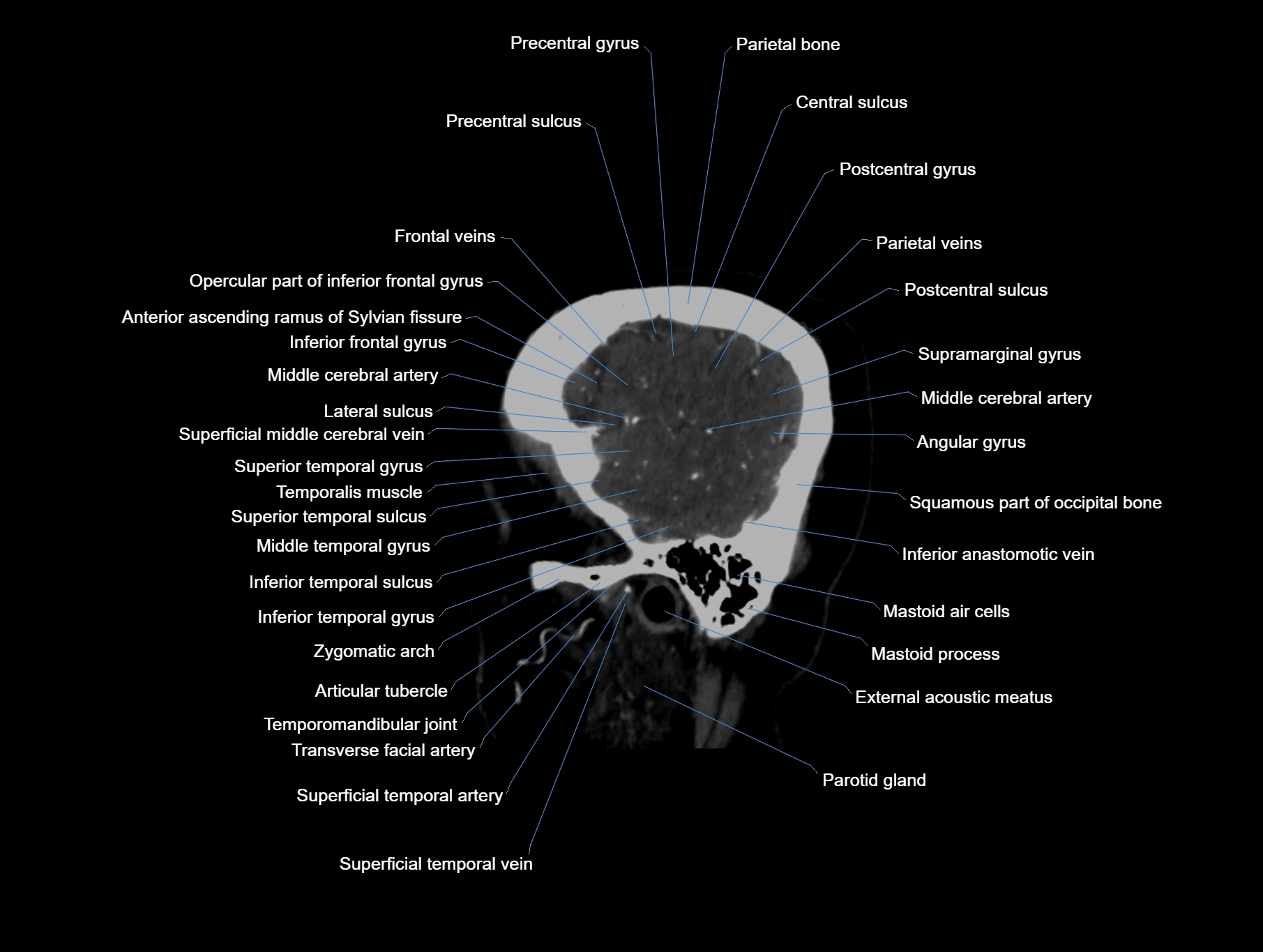 CT scan brain sagittal cross sectional anatomy image-img-00001-00010.webp